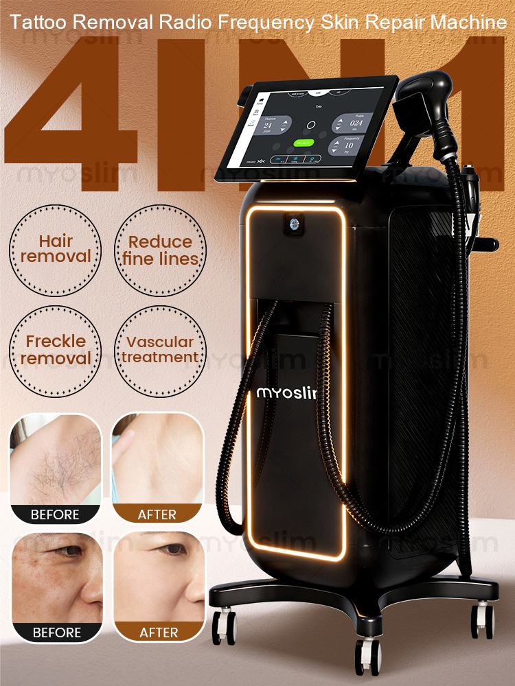 Industrial Laser Hair Removal Machine - 4 IN 1 ソプラノチタンアイスプラチナRFダイオード 755nm 808nm